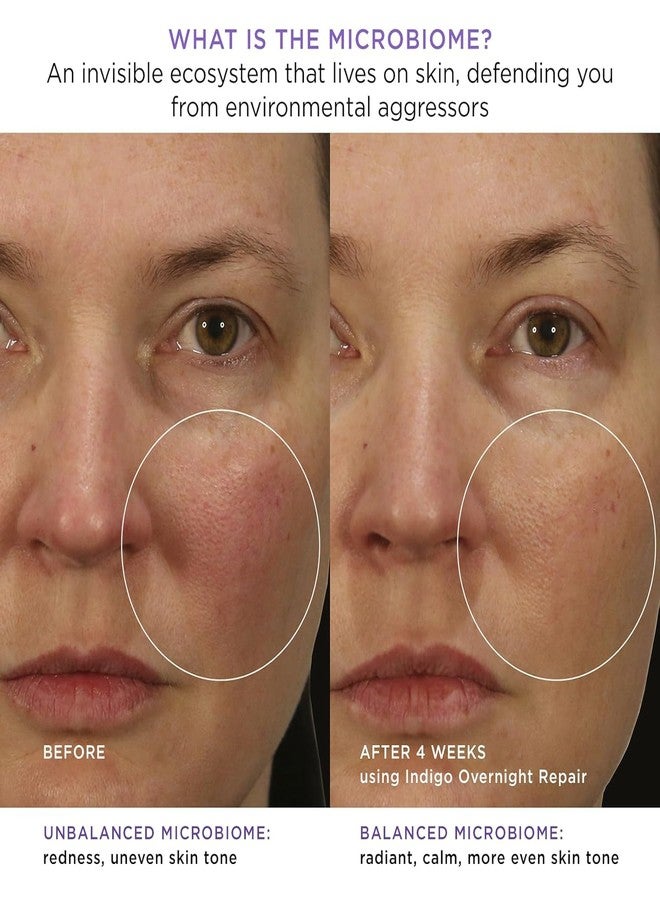 TATCHA Indigo Overnight Repair, Travel-Sized | Mini Redness Reducing, Barrier Reparing Cream - Calm Irritation and Improve Skin Barrier for Sensitive and Eczema-Prone Skin | 15 ml / 0.5 fl. oz. - Image 5